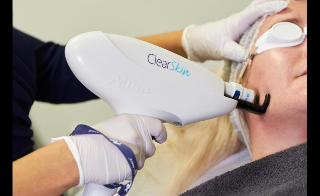 Clearskinstudycom